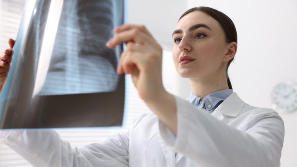 Φυματίωσης